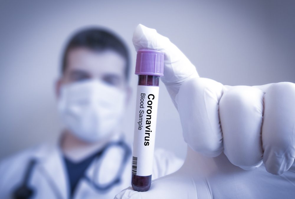 Doctoc evaluates a vial of coronavirus